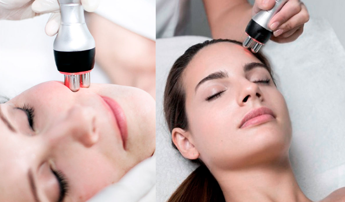 Tipos de tratamientos con radiofrecuencia